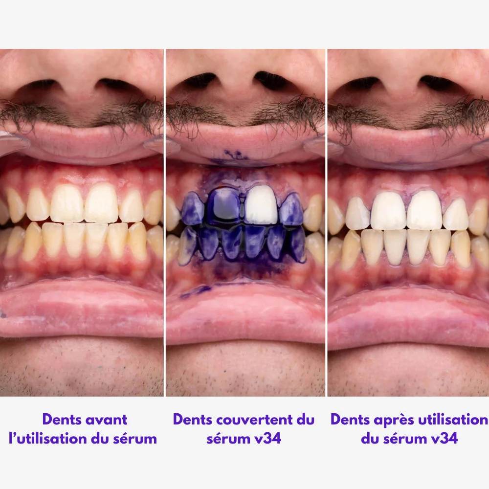 Sérum Correcteur de Couleur – Image 3